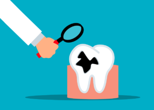 Cavities